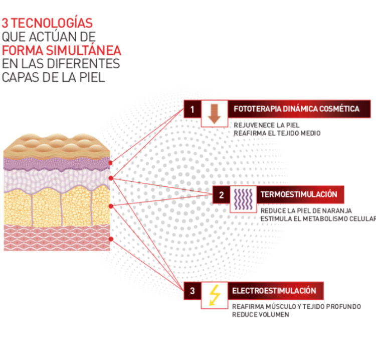 Tratamiento de remodelación corporal Sk