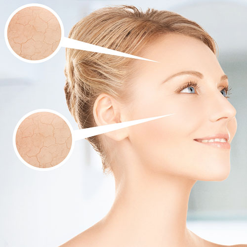 Tratamiento facial corrective